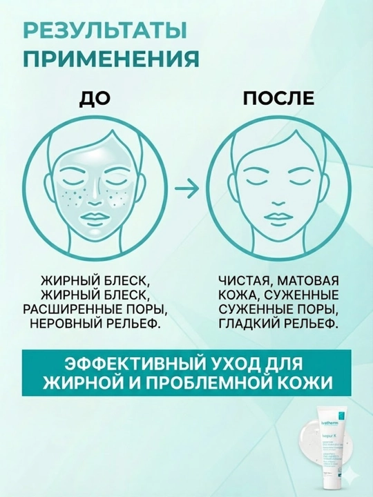 Ivatherm Ivapur K Крем для жирной кожи, склонной к акне, 30 мл