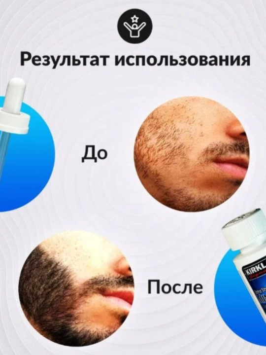Миноксидил для роста бороды и волос Kirkland Minoxidil 5%, 60 мл