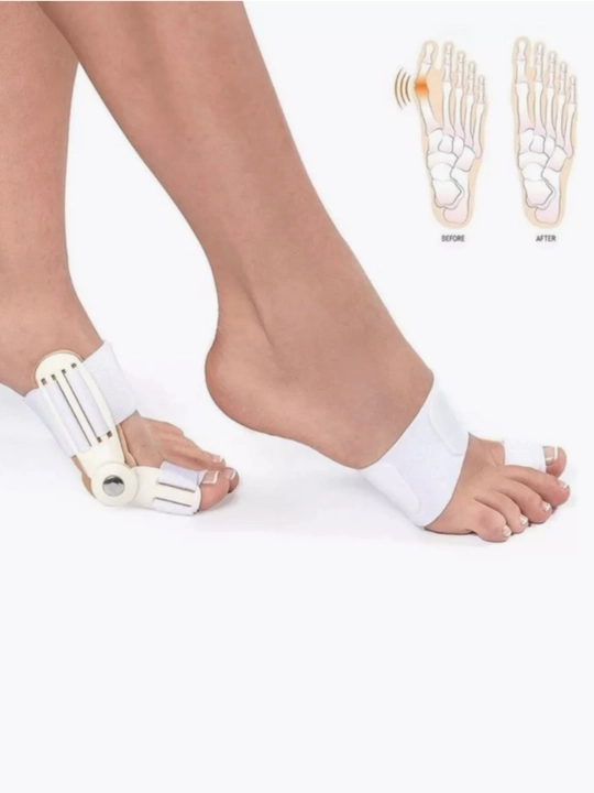 Valgus shinasi, bosh barmoq fiksator-korrektori, Hallux Valgusda oyoq fiksatori