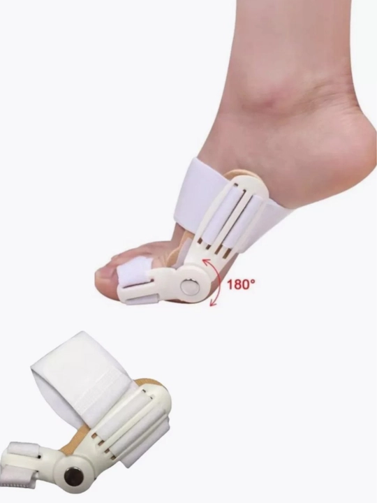 Valgus shinasi, bosh barmoq fiksator-korrektori, Hallux Valgusda oyoq fiksatori