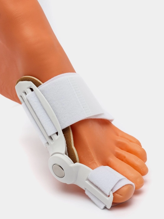 Valgus shinasi, bosh barmoq fiksator-korrektori, Hallux Valgusda oyoq fiksatori