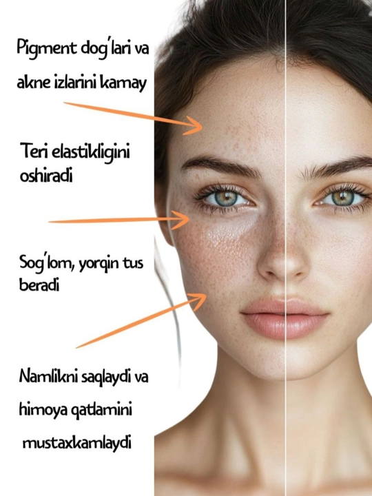 Pigment dog'larni kamaytirish uchun VITA-C return SERUM