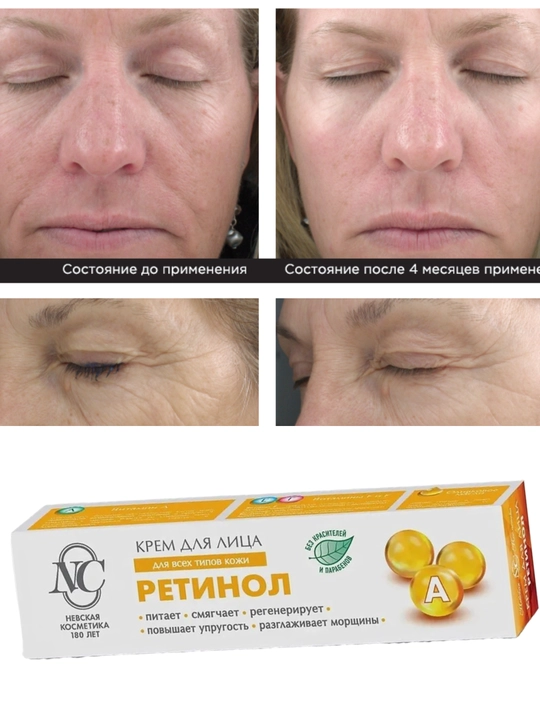 Retinol Pantenol Kollagen Gialuronli yuz kremlari namlik, oziqa yoshartirish va ajinlarga - 
