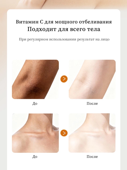 Отбеливающий крем для тела, удаляет пигментацию между ног, локтей, подмышек и коленей