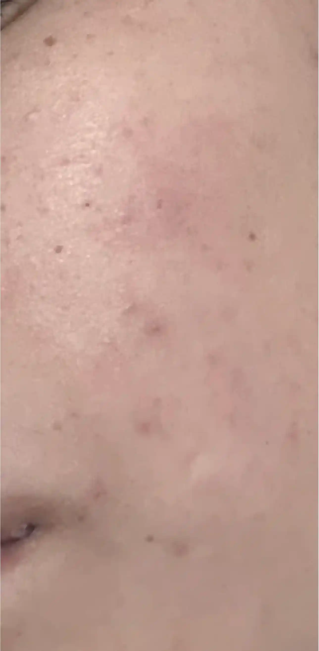 Yuz uchun,qora tochkaga qarshi oqartiruvchi Dark Spot Correcting Glow serum, Axis Y, 50 ml