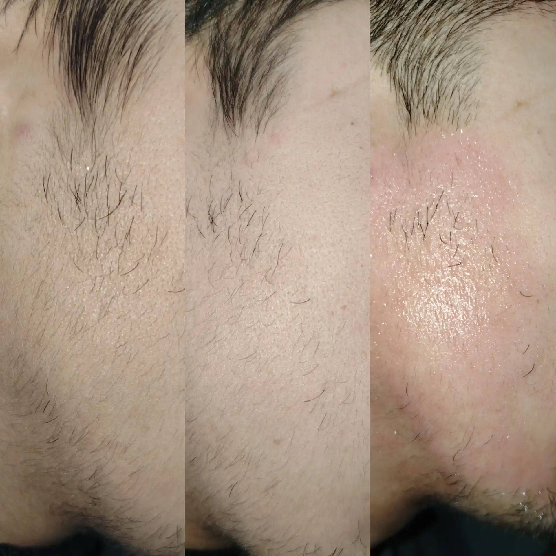 Миноксидил для роста бороды и волос Kirkland Minoxidil 5% 60 мл
