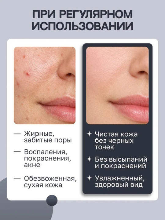 Пенка для умывания, пенка алоэ вера, очищающая пенка
