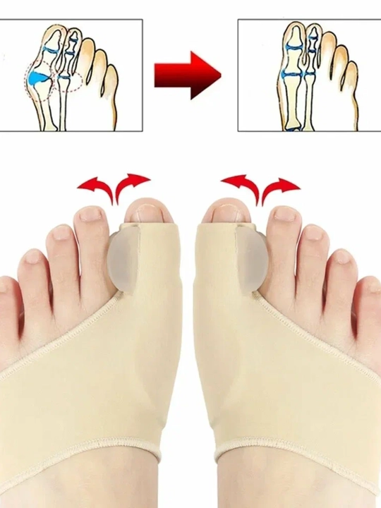 Oyoqdagi bosh barmoq qiyshikligini to'g'irlovchi Hallux Valgus, o'ng va chap oyoqlar uchun