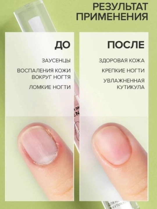 Набор 3в1 масло для кутикулы – профессиональный уход за ногтями 