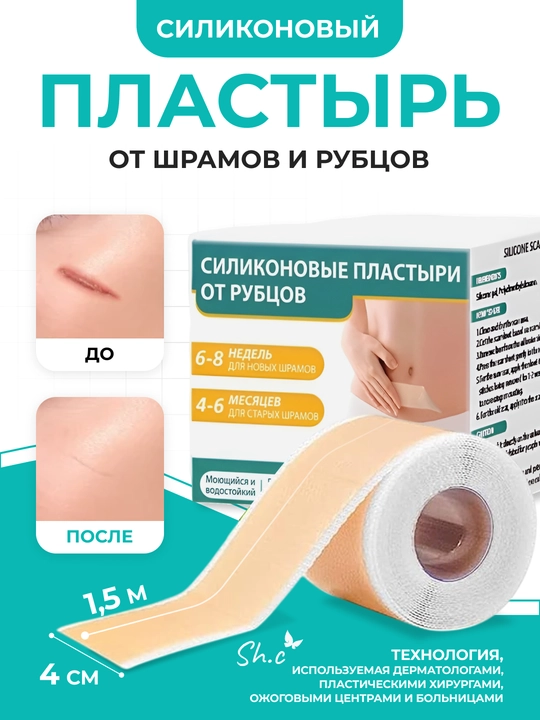 Силиконовый пластырь, лента от шрамов и рубцов, 1.5-3м