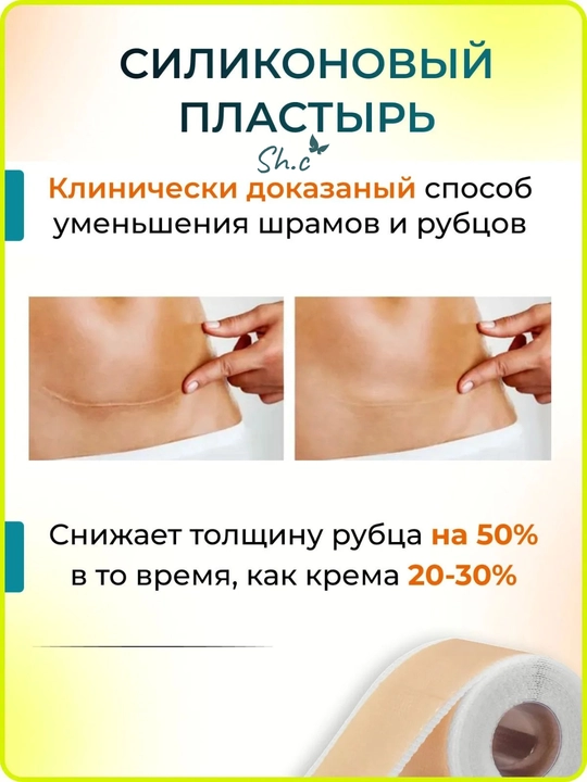 Силиконовый пластырь, лента от шрамов и рубцов, 1.5-3м