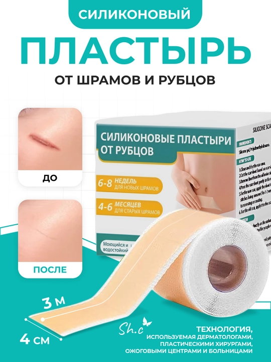 Силиконовый пластырь, лента от шрамов и рубцов, 1.5-3м - 
