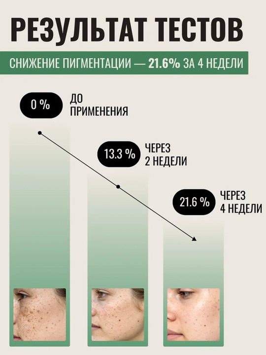 Сыворотка Axis-Y Dark Spot Correcting Glow Serum, осветляющая против пигментации, 50 мл