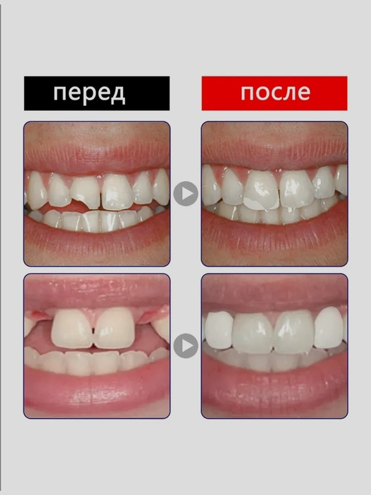 Виниры для зубов Moldable False Teeth, временная пломба, исправление зубов