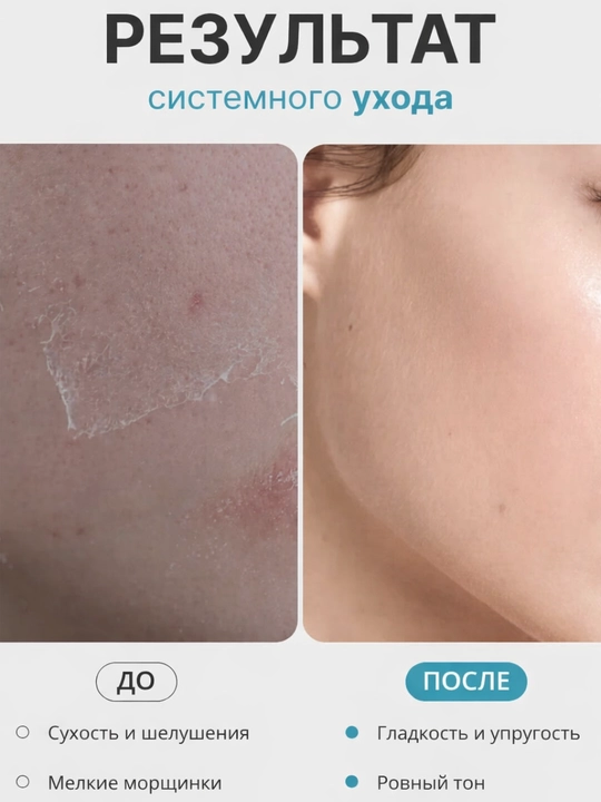 Сыворотка для лица Anua с PDRN, ниацинамидом, azelaic acid, против пигментации, для сияния