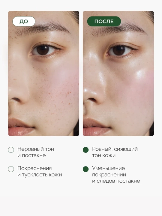 Сыворотка для лица Anua с PDRN, ниацинамидом, azelaic acid, против пигментации, для сияния