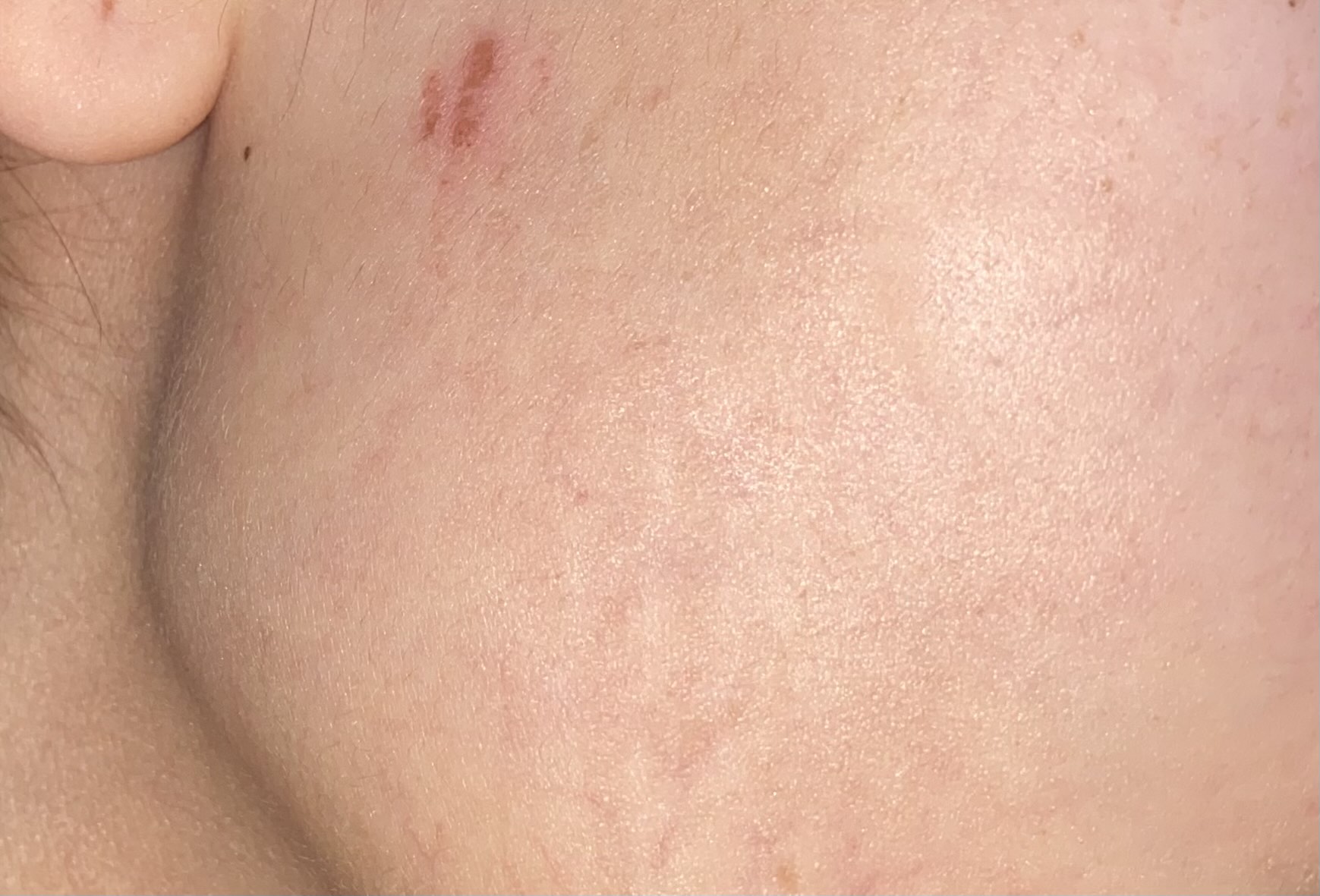 Kinesio тейп, лента для лица и тела, против морщин, пластырь спортивный, хлопок, 2 шт