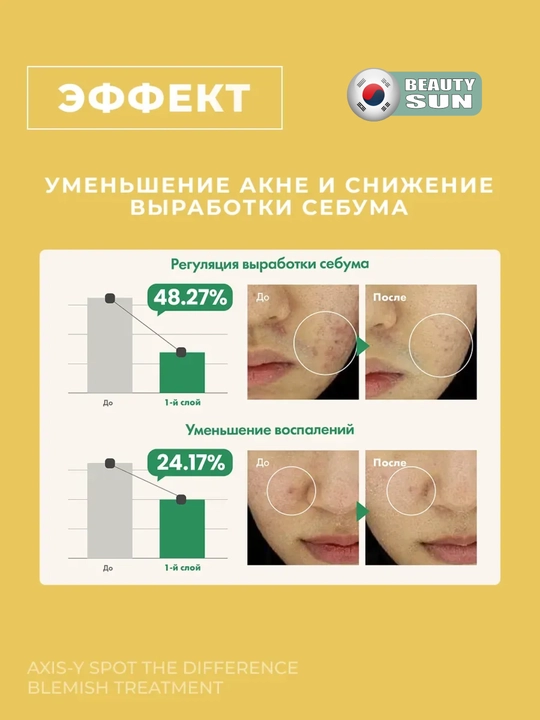 Yuz uchun spot, AXIS-Y, Spot the difference blemish treatment, 15 ml