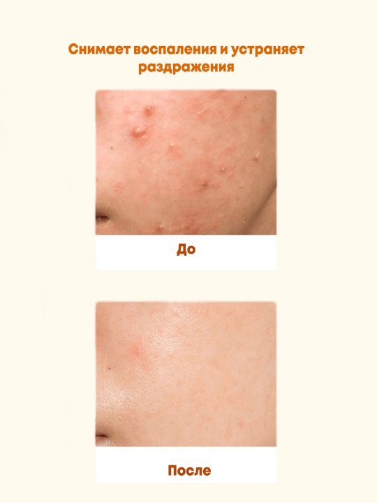 Ампульный гель для умывания с комплексом пробиотиков Manyo BifidaComplexAmpouleGelCleanser