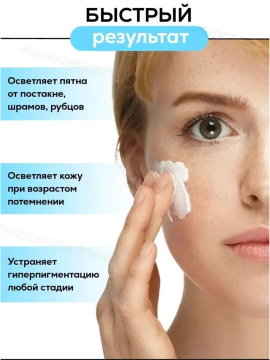 Крем отбеливающий, мазь для лица от пигментации мелазмы и веснушек Expigment 4%, 30 г