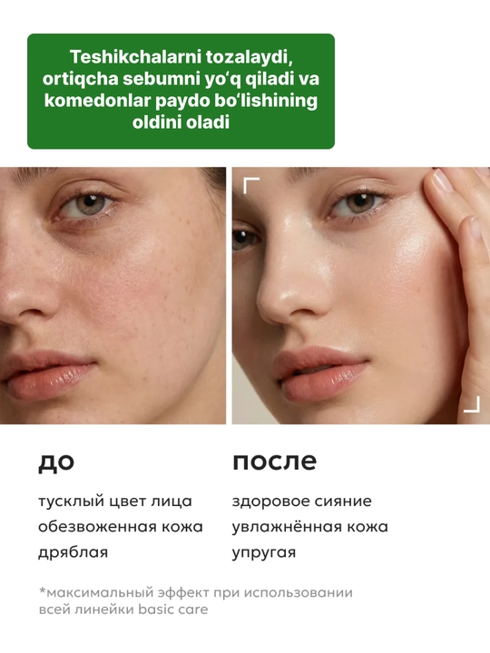 AXIS-Y centella va BHA kislotasi bilan kunlik tozalovchi tonik, ugri va akne uchun toner
