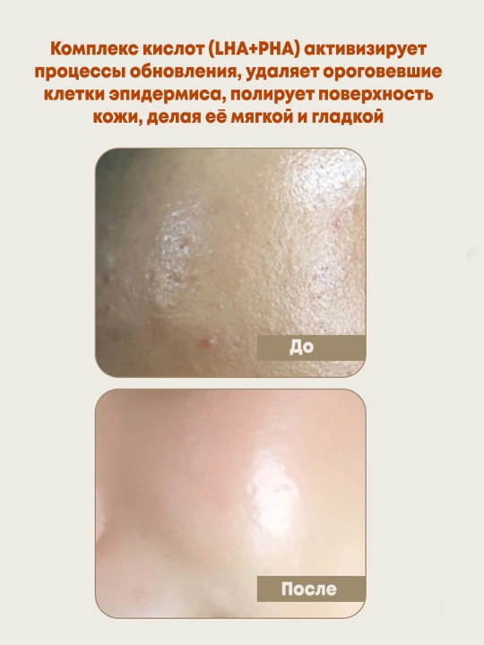 Кислотный тонер с галактомисисом для проблемной кожи Manyo Galactomy Clearskin Toner