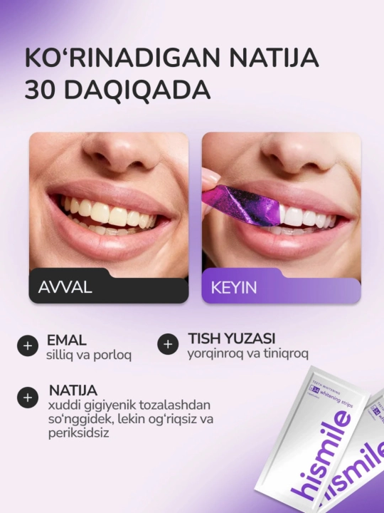 Отбеливающие полоски-патчи для зубов Hismile, полоски для отбеливания