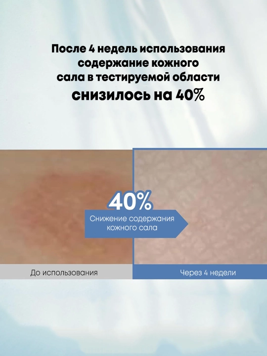 Yuqori sezgir teri uchun muloyim tozalovchi gel Lagom Cellup Gel To Water Cleanser
