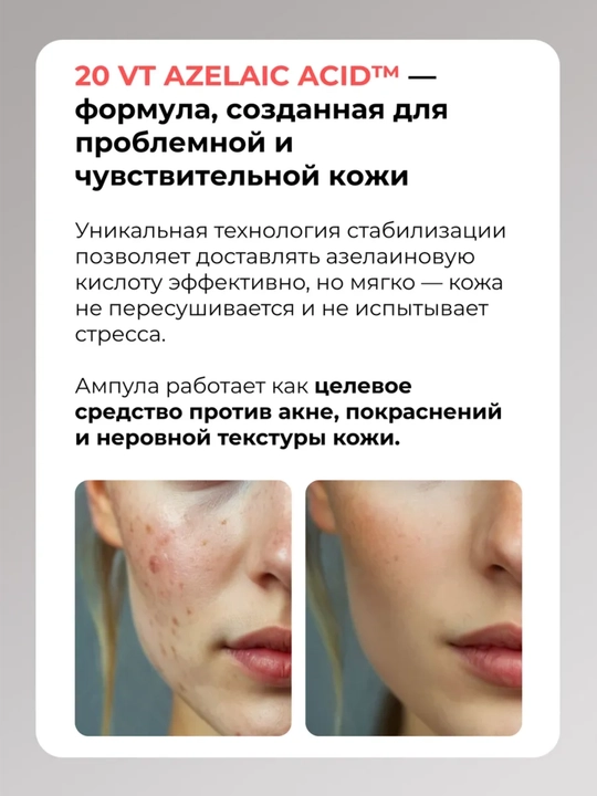 Сыворотка для лица VT Cosmetics: ретинол, лифтинг, коллаген, пептиды, центелла, 30 мл