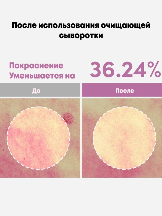 Сыворотка с азелаиновой кислотой против акне и комедонов Lagom Cellus Refining Purple Serum
