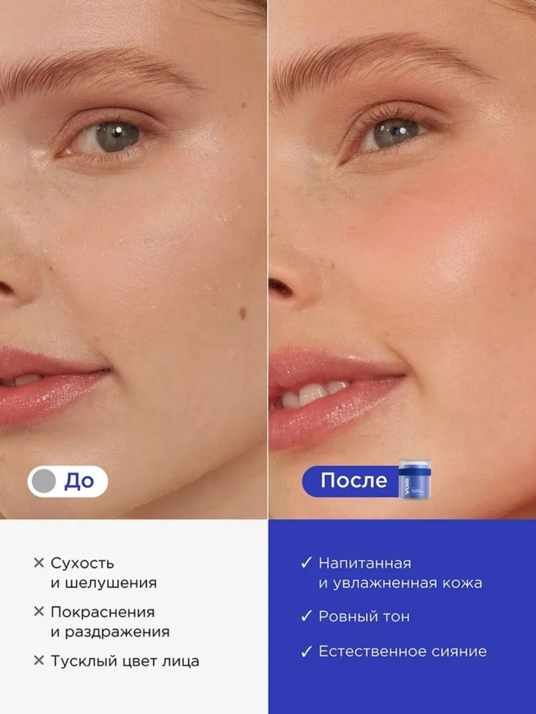VOIS yuz kremlari: namlantiruvchi, aknega qarshi, tungi, niatsinamid, Q10, anti-age, 50 ml