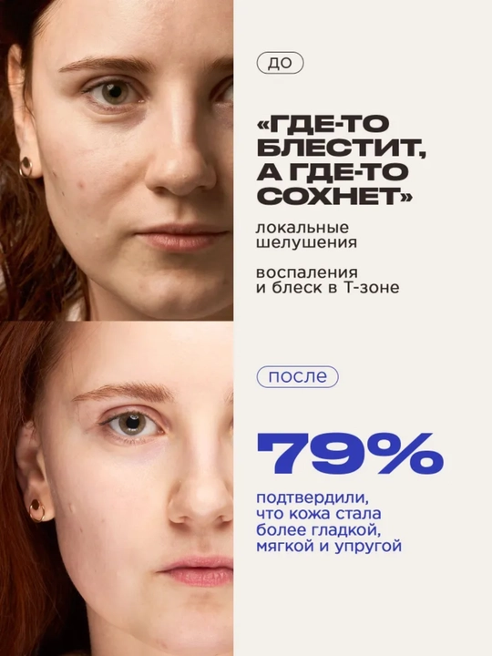 VOIS Кремы для лица: увлажняющий от акне, ночной, ниацинамидом, Q10, антивозрастной, 50 мл