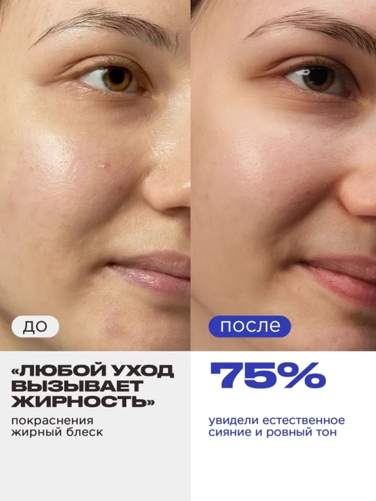 VOIS Кремы для лица: увлажняющий от акне, ночной, ниацинамидом, Q10, антивозрастной, 50 мл