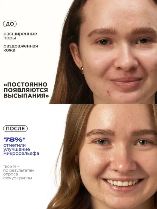 VOIS Кремы для лица: увлажняющий от акне, ночной, ниацинамидом, Q10, антивозрастной, 50 мл