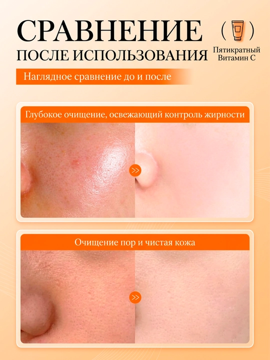Yuz uchun ko'pik, namlantiradi, 100 ml
