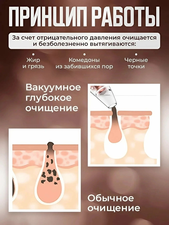 Вакуумный очиститель лица от черных точек, косметологический прибор