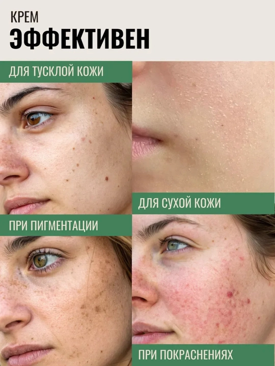 Tinchlantiruvchi krem gel, yuz kremi, koreys kosmetika, heartleaf krem, yog‘li teri