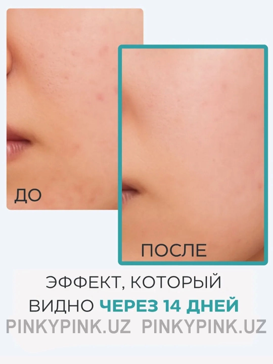 Очищающий тоник с азелаиновой кислоты Medicube Azelaic Acid Niacinamide Clear Toner, 250 мл