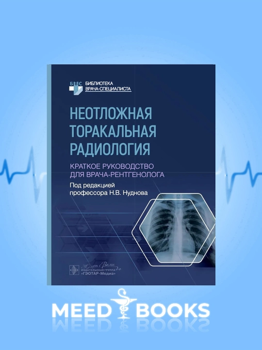 Shoshilinch torakal radiologiya — vrach-rentgenolog uchun qisqacha qo‘llanma, rus tilida - 