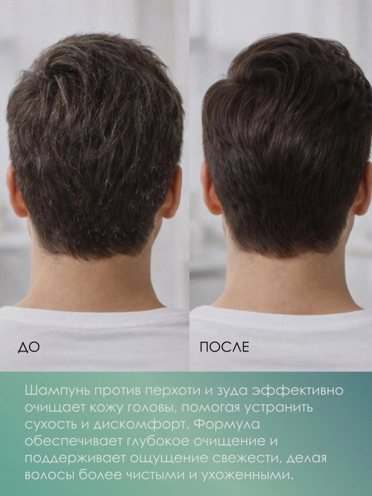 Шампунь против перхоти SiSi Love Rayhon Men's Anti-Dandruff Shampoo 425 мл