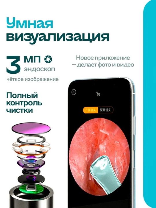 Kamera bilan aqlli quloq tozalagich, otoskop, yoritgich, Wi-Fi, silikon uchlar