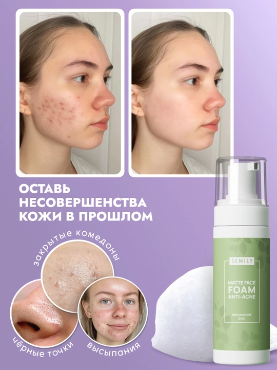 Yuz yuvish uchun penka Semily tozalovchi umivalka,yuzni tozalovchi,colagen penka,stop acne