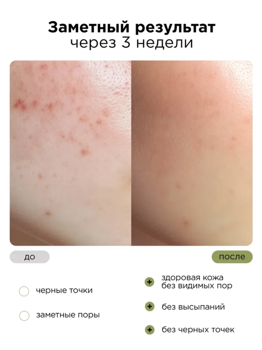 MIXIT gidrofil gel-moyi, PDRN va GREEN TEA ekstrakti bilan, sovg'aga mos formatda, 150ml