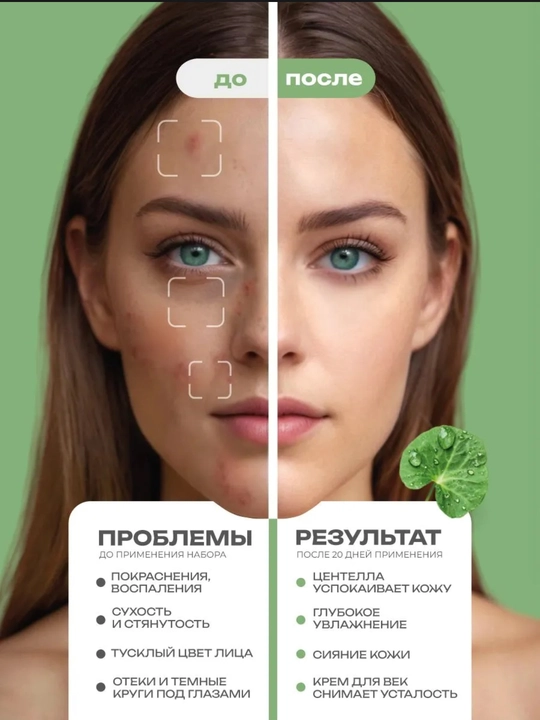 Крем для век Bioaqua Centella Asiatica против морщин, от тёмных кругов и отёков, 20 мл