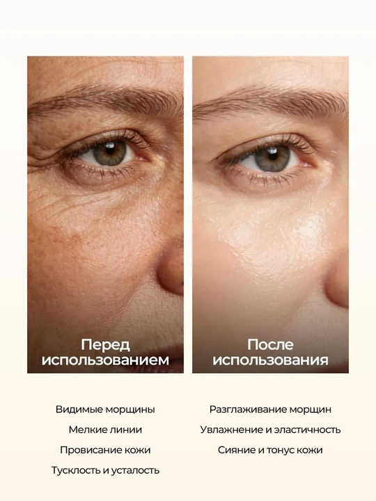OUHOE yoshartiruvchi va tortuvchi yuz kremi, asalari zahri va retinol bilan, 20g