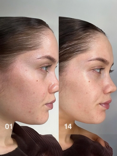 Rhode Glazing Увлажняющая эссенция для молока и лица