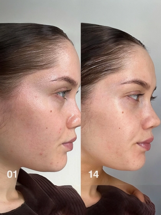 BIODANCE gel toner disklari