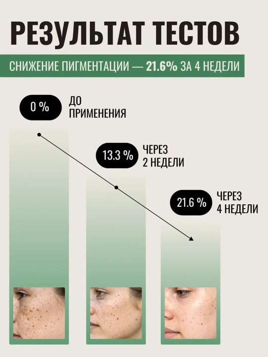 Axis-Y Dark Spot Correcting Glow Serum, 50 мл, Сыворотка для осветления пигментных пятен