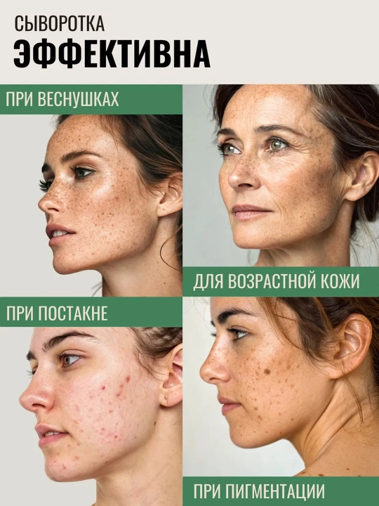 Axis-Y Dark Spot Correcting Glow Serum, 50 мл, Сыворотка для осветления пигментных пятен