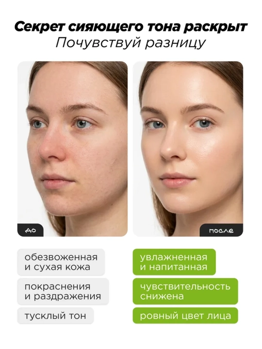 MIXIT NONI&MATCHA Тонеры для лица: увлажняющий, восстанавливающий, с нони и матчей, 150 мл